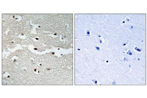Immunohistochemistry analysis of paraffin-embedded human brain tissue, using BRCA2 antibody. (BRCA2 antibody  (N-Term))