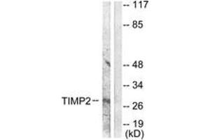 Western blot analysis of extracts from A549 cells, using TIMP2 Antibody. (TIMP2 antibody  (AA 21-70))