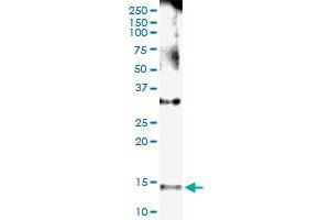 Immunoprecipitation of NPHP1 transfected lysate using anti-NPHP1 MaxPab rabbit polyclonal antibody and Protein A Magnetic Bead , and immunoblotted with NPHP1 MaxPab mouse polyclonal antibody (B01) . (NPHP1 antibody  (AA 1-121))