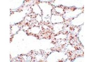 Immunohistochemistry (IHC) image for anti-Zinc Finger and SCAN Domain Containing 4 (ZSCAN4) (C-Term) antibody (ABIN1030831) (ZSCAN4 antibody  (C-Term))