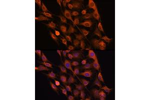Immunofluorescence analysis of C6 cells using RNH1 Rabbit pAb (ABIN1682553, ABIN3018507, ABIN3018508 and ABIN6220489) at dilution of 100 (40x lens). (RNH1 antibody  (AA 202-461))