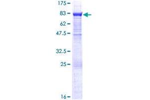 EPHX2 Protein (AA 1-555) (GST tag)