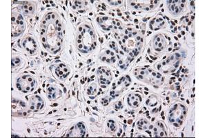 Immunohistochemical staining of paraffin-embedded breast tissue using anti-MAPK12 mouse monoclonal antibody. (MAPK12 antibody)