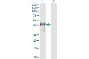 Western Blot analysis of PCGF4 expression in transfected 293T cell line by PCGF4 monoclonal antibody (M02), clone 4E10-1C5.
