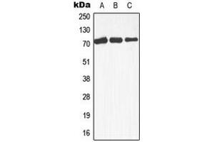Western blot analysis of MEKK3 expression in Raji (A), A431 (B), HepG2 (C) whole cell lysates. (MAP3K3 antibody  (Center))