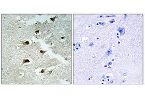 Immunohistochemistry (IHC) image for anti-Cell Division Cycle Associated 4 (CDCA4) (Internal Region) antibody (ABIN1850258) (CDCA4 antibody  (Internal Region))