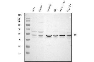 Western blot analysis of c-Fos/FOS using anti-c-Fos/FOS antibody (ABIN7601764).