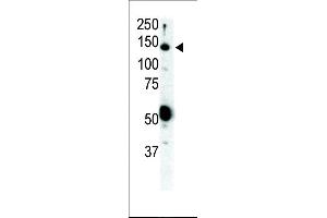 Western blot analysis of anti-Ret Pab (ABIN392038 and ABIN2841806) in SKBR3 cell lysate. (Ret Proto-Oncogene antibody  (N-Term))