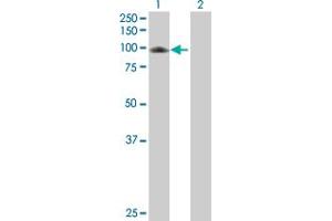 Western Blot analysis of C7 expression in transfected 293T cell line by C7 MaxPab polyclonal antibody. (C7 antibody  (AA 1-843))