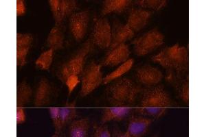 Immunofluorescence analysis of C6 cells using SMYD3 Polyclonal Antibody at dilution of 1:100. (SMYD3 antibody)