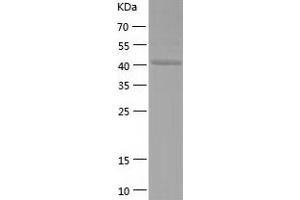 Western Blotting (WB) image for Synaptotagmin IV (SYT4) (AA 38-425) protein (His tag) (ABIN7288788) (SYT4 Protein (AA 38-425) (His tag))