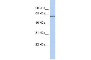 WB Suggested Anti-PCCB Antibody Titration: 0.
