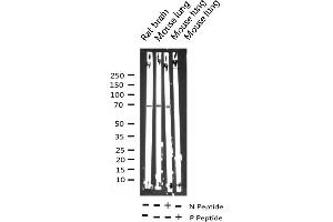 Western Blotting (WB) image for anti-Ribosomal Protein S6 Kinase, 70kDa, Polypeptide 1 (RPS6KB1) (pThr229) antibody (ABIN6255636)