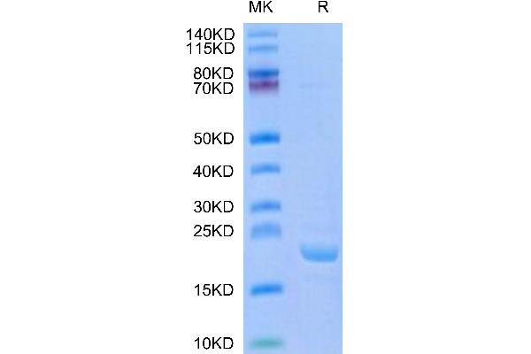 BPIFA1 Protein (AA 20-256)