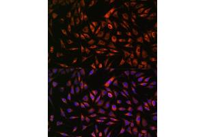 Immunofluorescence analysis of L929 cells using EML4 antibody (ABIN7266891) at dilution of 1:100. (EML4 antibody  (AA 360-560))