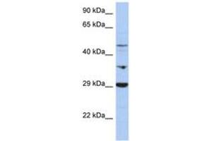 Image no. 1 for anti-Pyruvate Dehydrogenase Kinase, Isozyme 3 (PDK3) (C-Term) antibody (ABIN6743407)