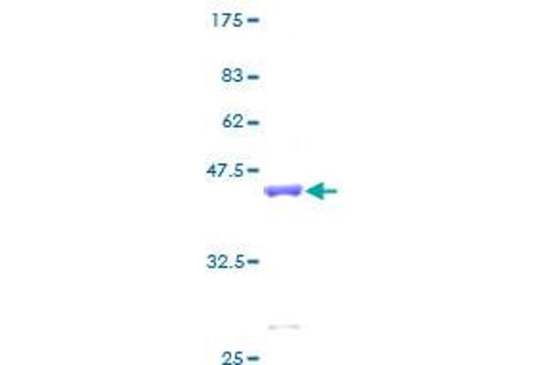 NPC2 Protein (AA 1-151) (GST tag)