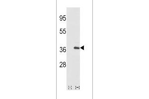 Western blot analysis of IL1A using rabbit polyclonal IL1A-pS87 using 293 cell lysates (2 ug/lane) either nontransfected (Lane 1) or transiently transfected with the IL1A gene (Lane 2). (IL1A antibody  (AA 65-94))