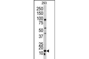 Western blot analysis of BLC antibody (N-term) (ABIN390537 and ABIN2840880) in 293 cell line lysates (35 μg/lane). (BAALC antibody  (N-Term))