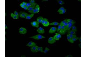 Immunofluorescence staining of HepG2 cells with ABIN7170110 at 1:66, counter-stained with DAPI.