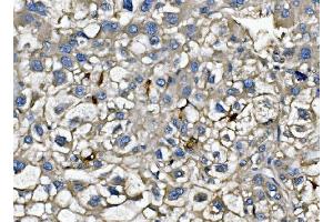 IHC analysis of CXCL12 using anti-CXCL12 antibody (ABIN6719467). (CXCL12 antibody  (AA 24-93))
