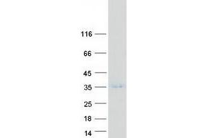 Validation with Western Blot