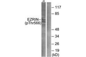 Western Blotting (WB) image for anti-Ezrin (EZR) (pThr566) antibody (ABIN2888413) (Ezrin antibody  (pThr566))