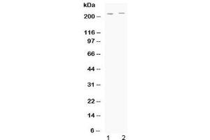 Western blot testing of human 1) HeLa and 2) A549 cell lysate with ABCC1 antibody at 0.