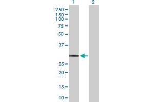 Western Blot analysis of HLA-DQA1 expression in transfected 293T cell line by HLA-DQA1 MaxPab polyclonal antibody. (HLA-DQA1 antibody  (AA 1-255))