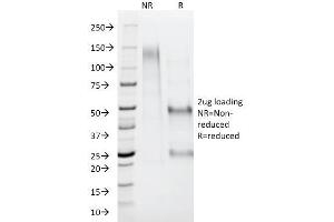 SDS-PAGE (SDS) image for anti-alpha-Methylacyl-CoA Racemase (AMACR) antibody (ABIN6939433)