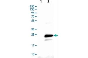 Western blot analysis of Lane 1: Negative control (vector only transfected HEK293T lysate), Lane 2: Over-expression Lysate (Co-expressed with a C-terminal myc-DDK tag (~3. (CMTM6 antibody)