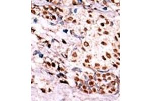 Image no. 2 for anti-Met Proto-Oncogene (MET) (pTyr1349) antibody (ABIN358164) (c-MET antibody  (pTyr1349))