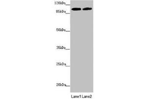 Western blot All lanes: PDE6A antibody at 3. (PDE6A antibody  (AA 656-860))