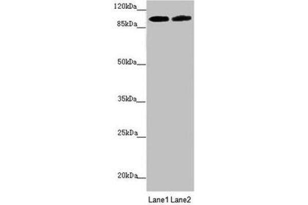 PDE6A antibody  (AA 656-860)