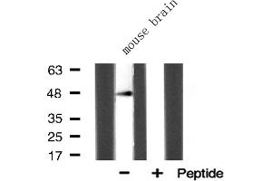 Western blot analysis of ACOT4 Antibody expression in mouse brain tissue lysates.