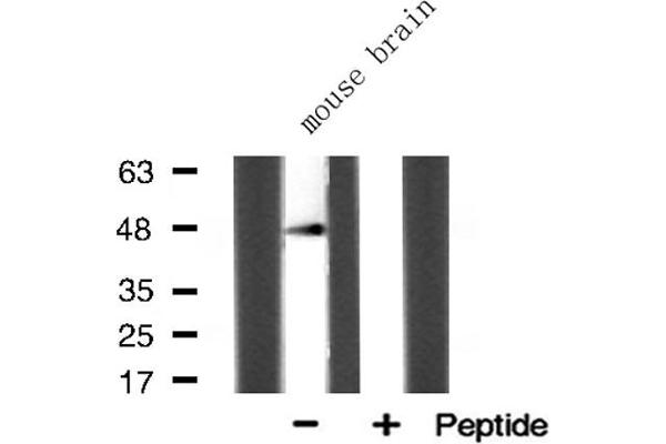 ACOT4 antibody  (C-Term)