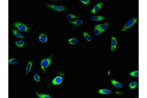 Immunofluorescent analysis of Hela cells using ABIN7170019 at dilution of 1:100 and Alexa Fluor 488-congugated AffiniPure Goat Anti-Rabbit IgG(H+L) (SLC5A1 antibody  (AA 239-288))