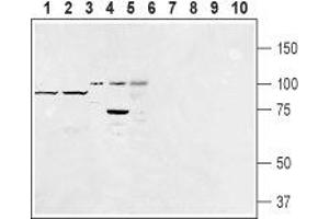 Western blot analysis of rat fat (lanes 1 and 6), mouse fat (lanes 2 and 7), human Burkitt's lymphoma (Raji) (lanes 3 and 8), rat basophilic leukemia (RBL) (lanes 4 and 9) and human promyelocytic leukemia (HL-60) (lanes 5 and 10) lysates: - 1-5.