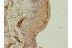 Immunohistochemistry of paraffin-embedded human skin tissue using ABIN7144821 at dilution of 1:100 (ATM Interactor antibody  (AA 160-360))