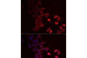 Immunofluorescence analysis of MCF7 cells using P2RX4 Polyclonal Antibody (P2RX4 antibody)