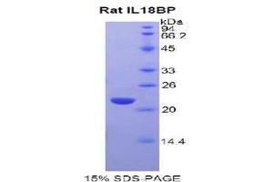 SDS-PAGE analysis of Rat IL18BP Protein.