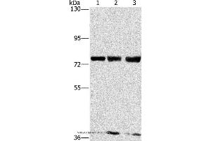 Western blot analysis of MCF7, hela and 293T cell, using GGCX Polyclonal Antibody at dilution of 1:400 (GGCX antibody)