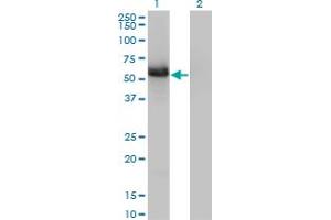 Western Blot analysis of GIT2 expression in transfected 293T cell line by GIT2 monoclonal antibody (M01), clone 3B5-B9. (GIT2 antibody  (AA 1-471))