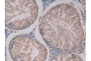 Used in DAB staining on fromalin fixed paraffin- embedded stomach tissue (GAS6 antibody  (AA 100-312))