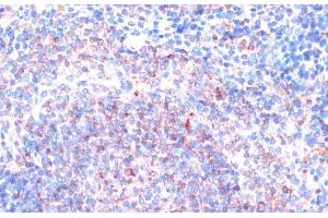 Immunohistochemistry of paraffin-embedded Mouse spleen using P90RSK Polyclonal Antibody at dilution of 1:100 (40x lens). (RPS6KA3 antibody)