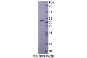 SDS-PAGE analysis of Mouse TFR2 Protein. (Transferrin Receptor 2 Protein (TFR2))