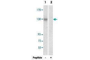 Western blot analysis of extracts from Jurkat cells, using C14orf49 polyclonal antibody .