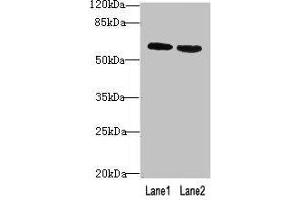 Western blot All lanes: BTN2A2 antibody at 10 μg/mL Lane 1: MCF-7 whole cell lysate Lane 2: NIH/3T3 whole cell lysate Secondary Goat polyclonal to rabbit IgG at 1/10000 dilution Predicted band size: 60, 38, 29, 46, 36 kDa Observed band size: 60 kDa (BTN2A2 antibody  (AA 33-262))