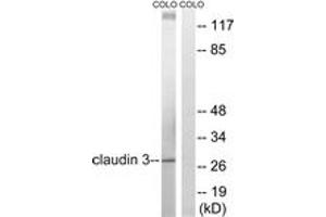 Western blot analysis of extracts from COLO205 cells, treated with EGF 200ng/ml 30', using Claudin 3 (Ab-219) Antibody. (Claudin 3 antibody  (AA 171-220))