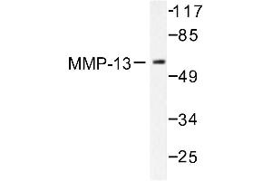 Image no. 1 for anti-Matrix Metallopeptidase 13 (Collagenase 3) (MMP13) antibody (ABIN265524) (MMP13 antibody)